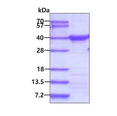 SDS-PAGE: Recombinant Human Cyclin H His Protein [NBP1-44483]